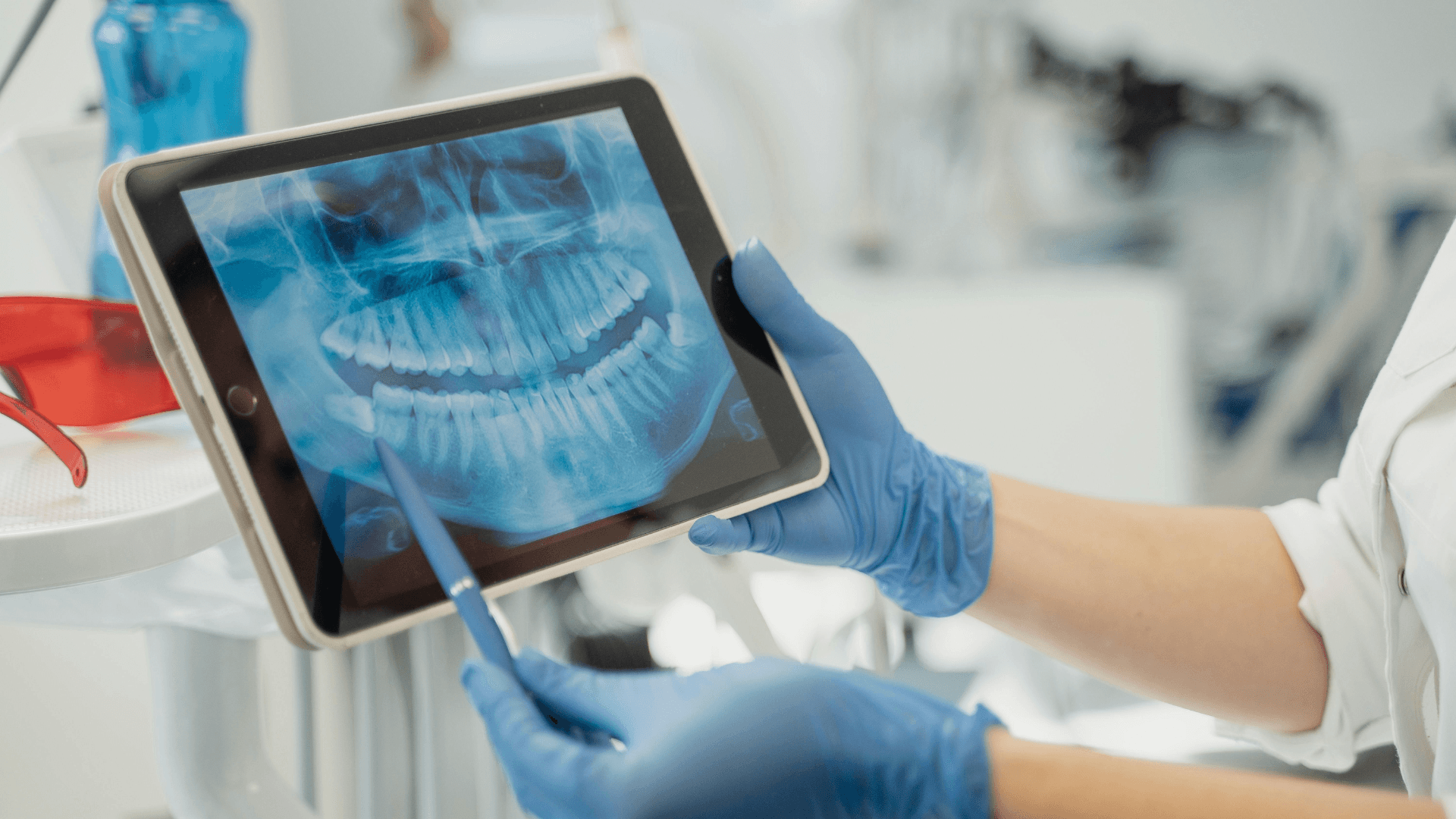 Exemple de cas clinique de rééducation myofonctionnelle assistée par MyoSimple